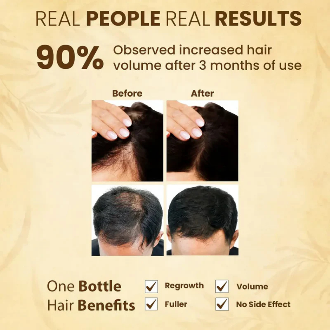 Jamalgota™ - Ayurvedic Hair Growth Powder 🌱✨