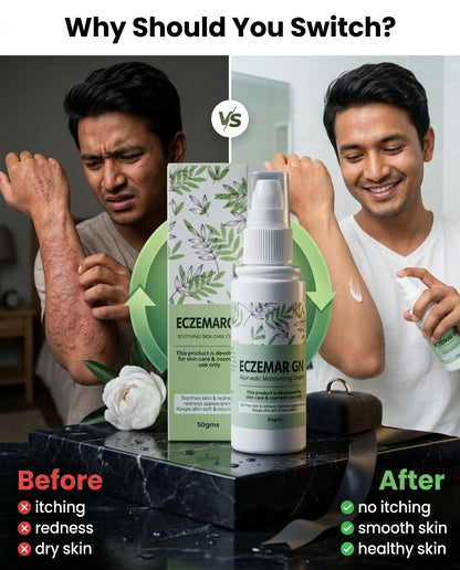 🧴🌿 Eczemar GN – Ayurvedic Psoriasis & Eczema Moisturizing Cream 🌱✨